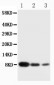 Anti-PF4 Antibody